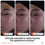 Youth To The People Superfruit Facial Cleanser - Papaya + Vitamin C Gentle Exfoliating Face Wash, Cellular Skin Renewal With Aha + Bha, Evens Skin Tone & Texture For Soft + Radiant Skin, Sulfate-Free