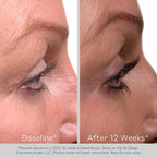 Obagi Nu-Cil Eyelash Enhancing Serum – Nourishing Lash Serum With Biotin For Thicker & More Defined-Looking Lashes