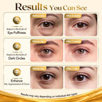 16 Pcs 24K Gold Collagen Under Eye Patches & Smile Line Patches | Sodium Hyaluronate & Cica Eye Masks For Plump,Smooth-Looking Under Eyes,Ideal For Late Nights And Screen Time