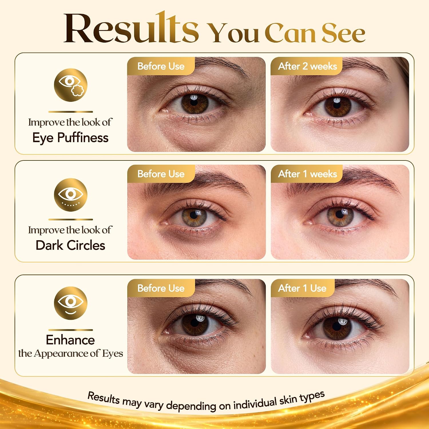 16 Pcs 24K Gold Collagen Under Eye Patches & Smile Line Patches | Sodium Hyaluronate & Cica Eye Masks For Plump,Smooth-Looking Under Eyes,Ideal For Late Nights And Screen Time