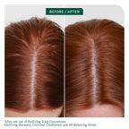 Biolage Scalp Sync Clarifying Shampoo - Residue & Buildup Remover, For Oily Scalp