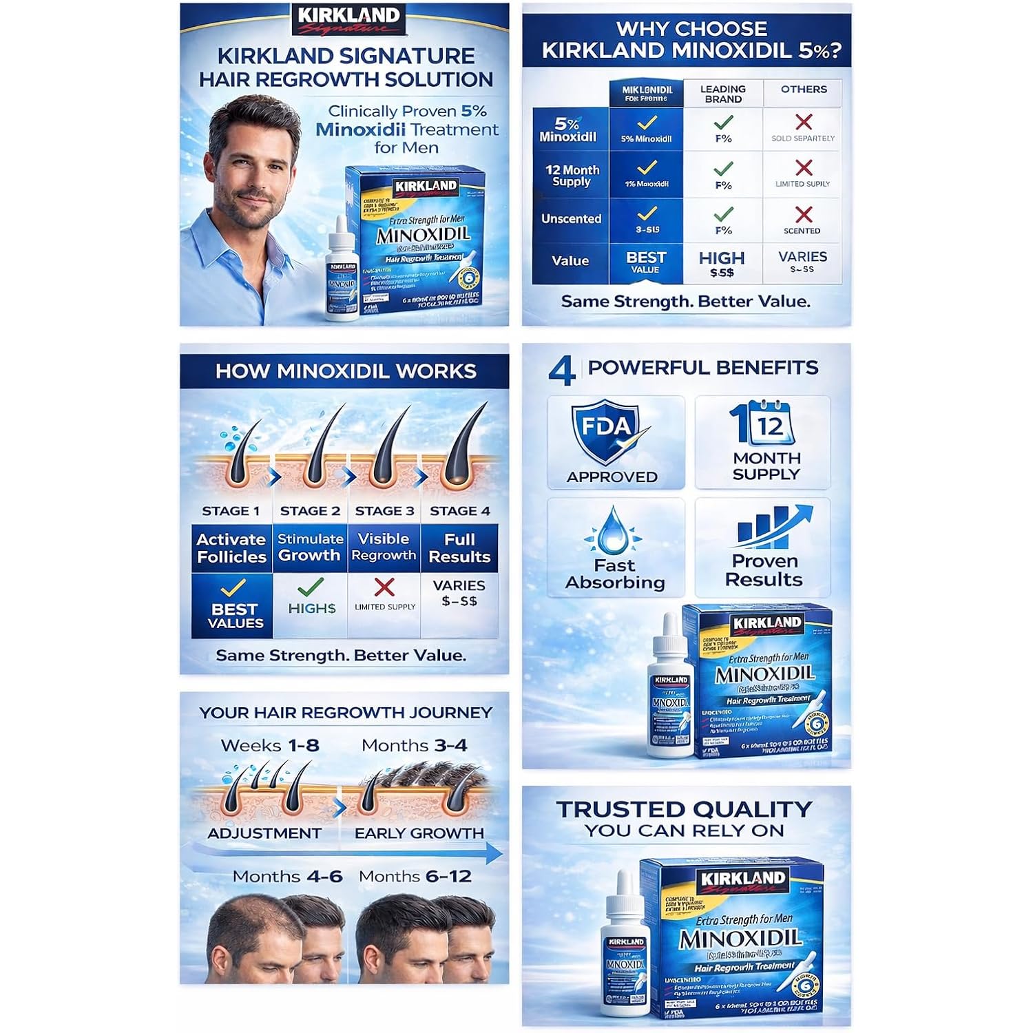 Kirkland Minoxidil 5% Extra Strength Men Hair Regrowth (12 Month Supply)