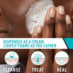 Cerave Acne Foaming Cream Cleanser, 4% Benzoyl Peroxide Face Wash With Hyaluronic Acid, Niacinamide & Ceramides, Gentle Daily Acne Treatment For Face