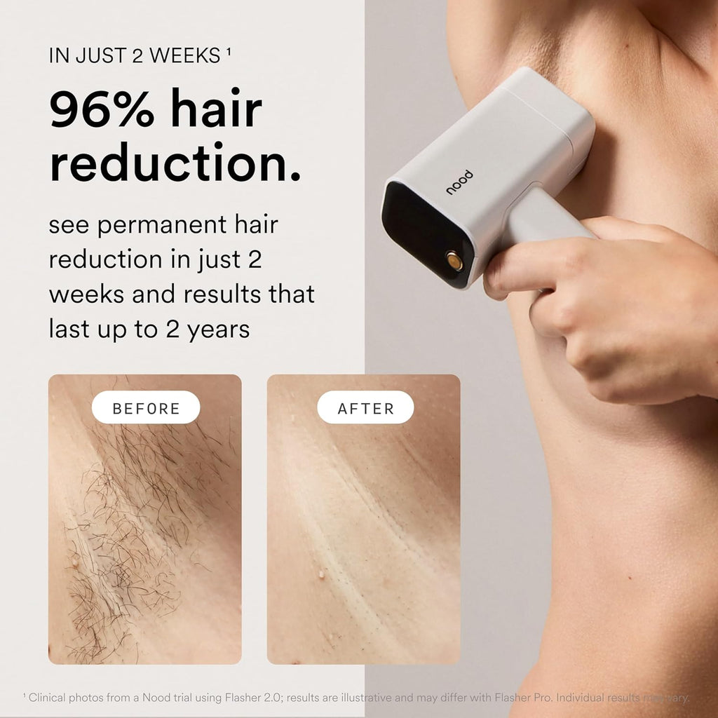 Nood™ Flasher Pro — Forbes Best Product 2026 — IPL Laser Hair Removal Device For At Home Use — Pain-Free, Permanent, Visible Results After First Use & Works Everywhere Hair Grows — Gloss White
