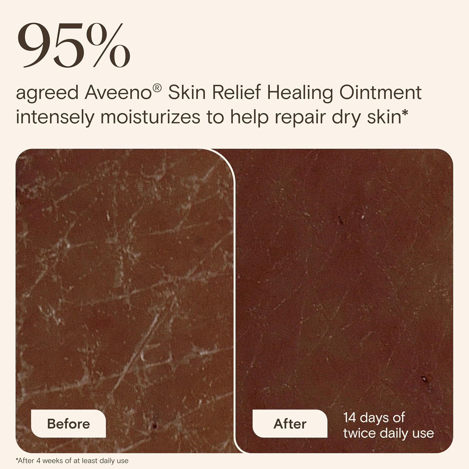 Aveeno Skin Relief Healing Ointment, Repair & Protect Extra Dry, Cracked Skin, Glycerin Protectant With Triple Oat & Shea Butter, Fragrance-Free & Non-Greasy Feel, Travel Size, 2.0 Oz