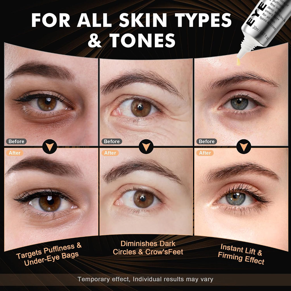 Kkp Perfection Eye Tightener With Brush, Instant Firming Formula #526589 (20Ml)