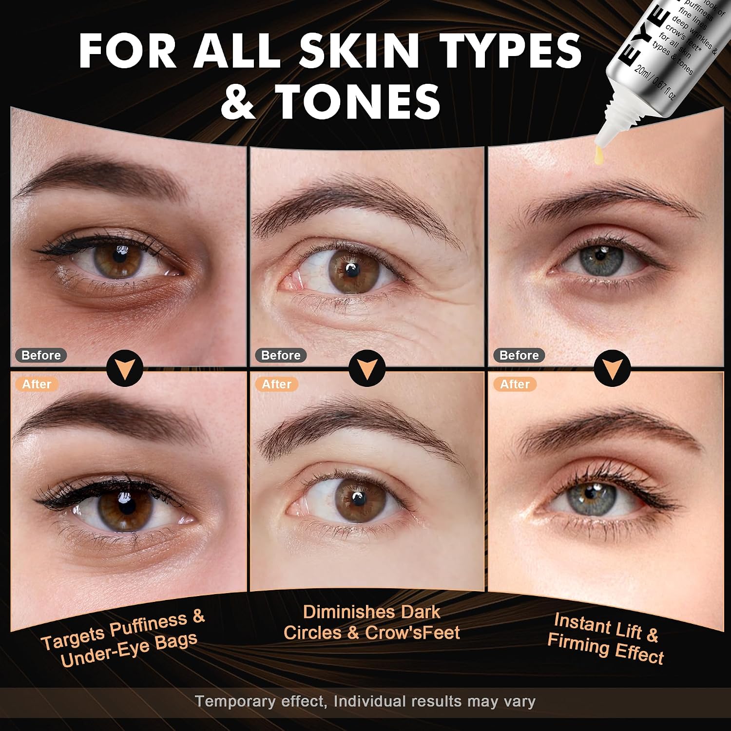 Kkp Perfection Eye Tightener With Brush, Instant Firming Formula #526589 (20Ml)