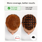 iRestore Professional Laser Red Light Therapy for Hair Growth System - FDA Cleared Hair Loss, Hair Thinning & Alopecia Treatment for Men & Women - 282 Lasers & LEDs