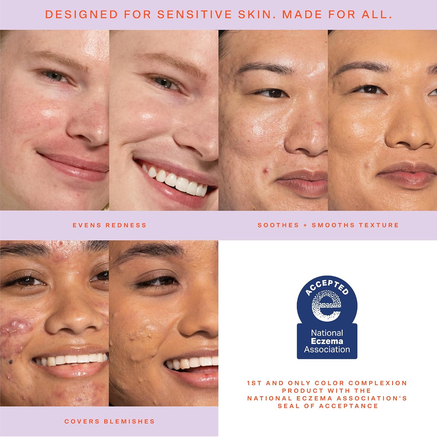 Tower 28 Sunnydays Spf 30 Tinted Moisturizer - 2-In-1 Buildable Coverage Foundation + Mineral Sunscreen For Face - Zinc Oxide, Aloe & Prickly Pear For Sensitive Skin - 10 Fair/Yellow (1 Oz)