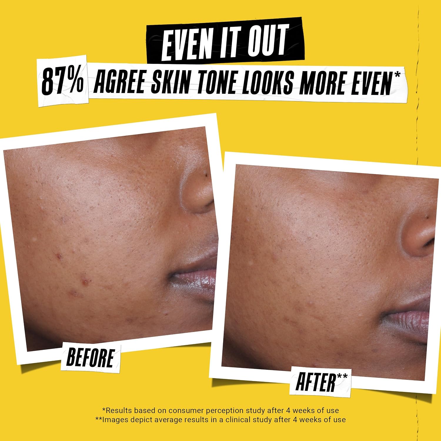 Kiehl'S Better Screen Uv Serum Spf 50+, Invisible Facial Sunscreen With Collagen Peptide, Uv Filters To Shield Uva & Uvb, Helps Correct Visible Signs Of Aging, Boosts Skin Radiance