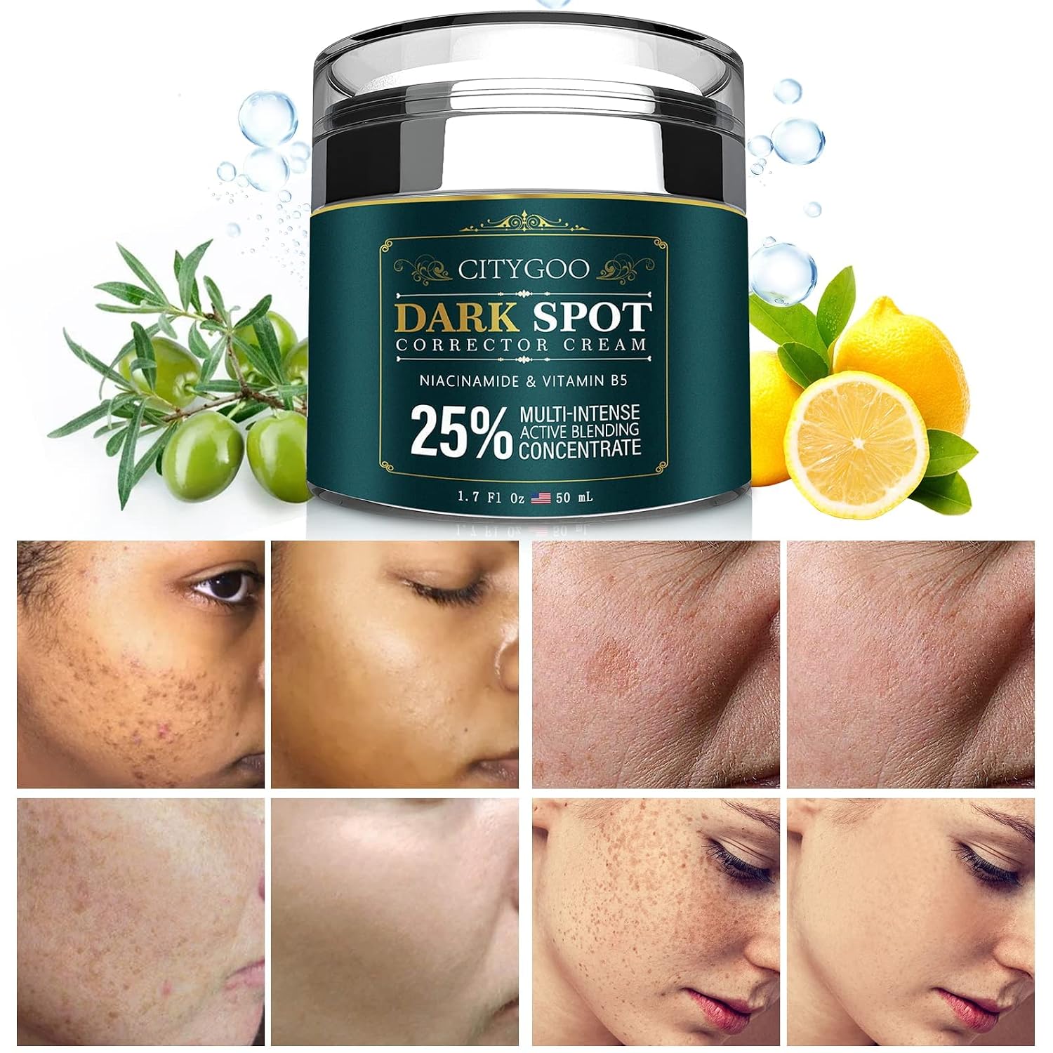 Citygoo Dark Spot Remover For Face: Dark Spot Corrector Cream - Enriching Skin Care For All Skin Tones - Melasma Freckle Sun Spot Remover & Blemish Reducer-1.7 Fl Oz