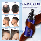 5% Minoxidil Hair Growth for Men and Women: 2-Pack Extra Strength Minoxidil Hair Loss Treatment Serum with Rosemary for Faster Stronger Thicker Hair Growth - 4 FL OZ