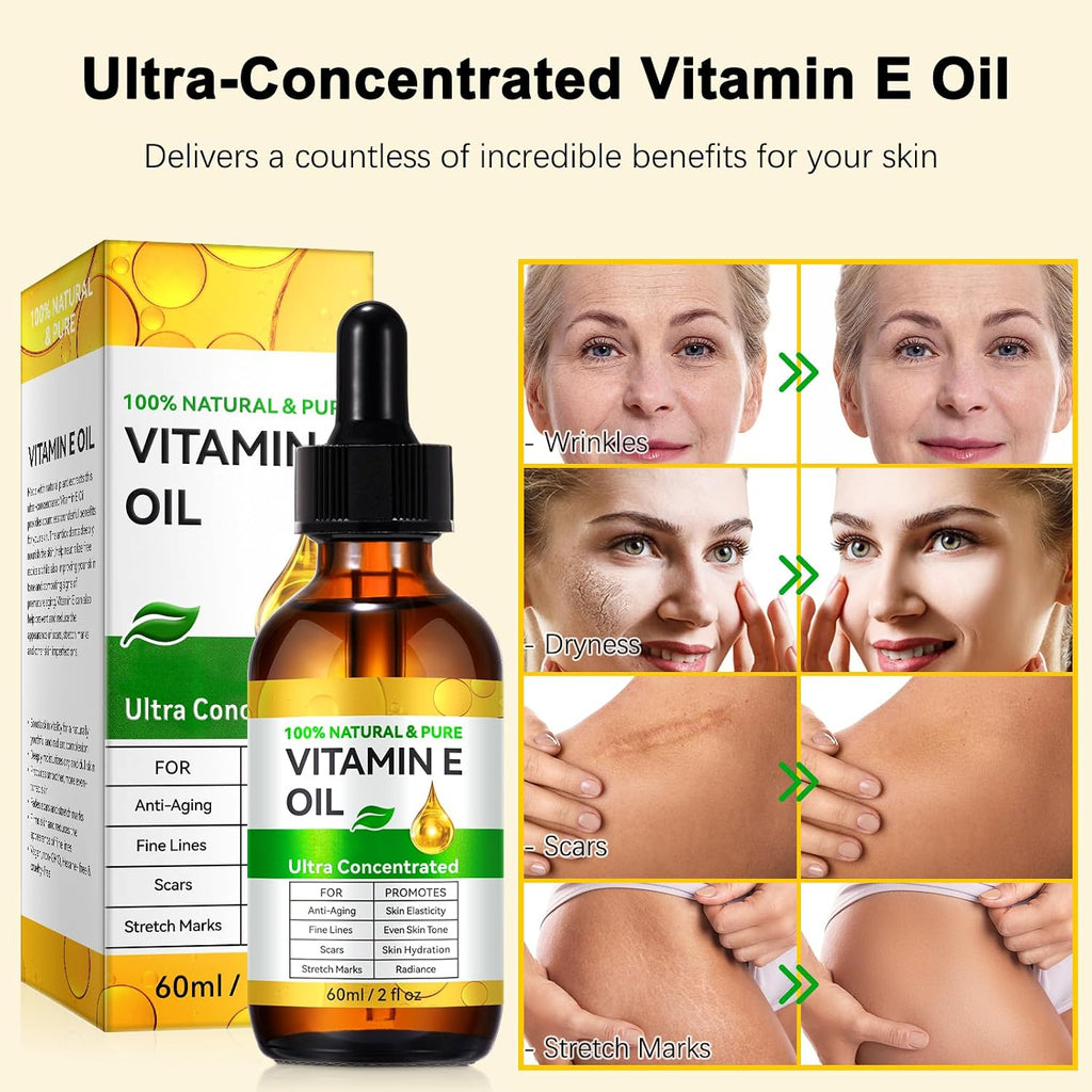 Flasture Vitamin E Oil 75,000 Iu – 100% Pure Natural Vitamin E For Skin, Face, Hair, Scars – Deep Moisturizing Body Oil For Dry Skin, Wrinkles – Cold-Pressed, Non-Gmo,Skincare – 2 Fl Oz
