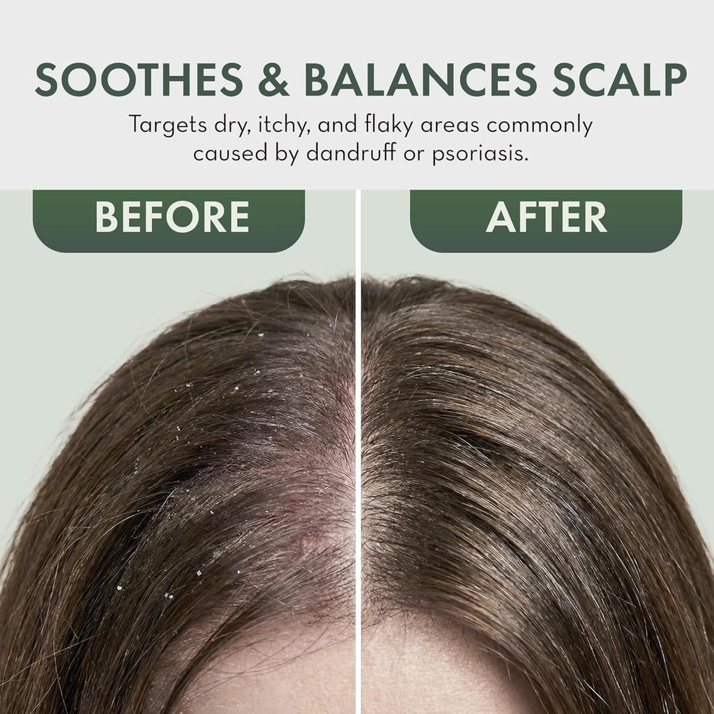 Leave In Conditioner Spray - Tea Tree Scalp Treatment - Anti-Dandruff and Dry & Itchy Scalp Treatment, Hydrating & Medicated Formula for Psoriasis and Scalp Care - Detangles & Nourishes Hair.