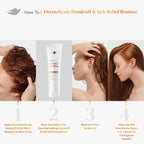 Dove Derma Scalp Dandruff & Itch Relief Conditioner 1 Ct With Pyrithione Zinc, Lamellar Serum And Niacinamide Or Flaky, Itchy Scalp Relief 9 Fl Oz
