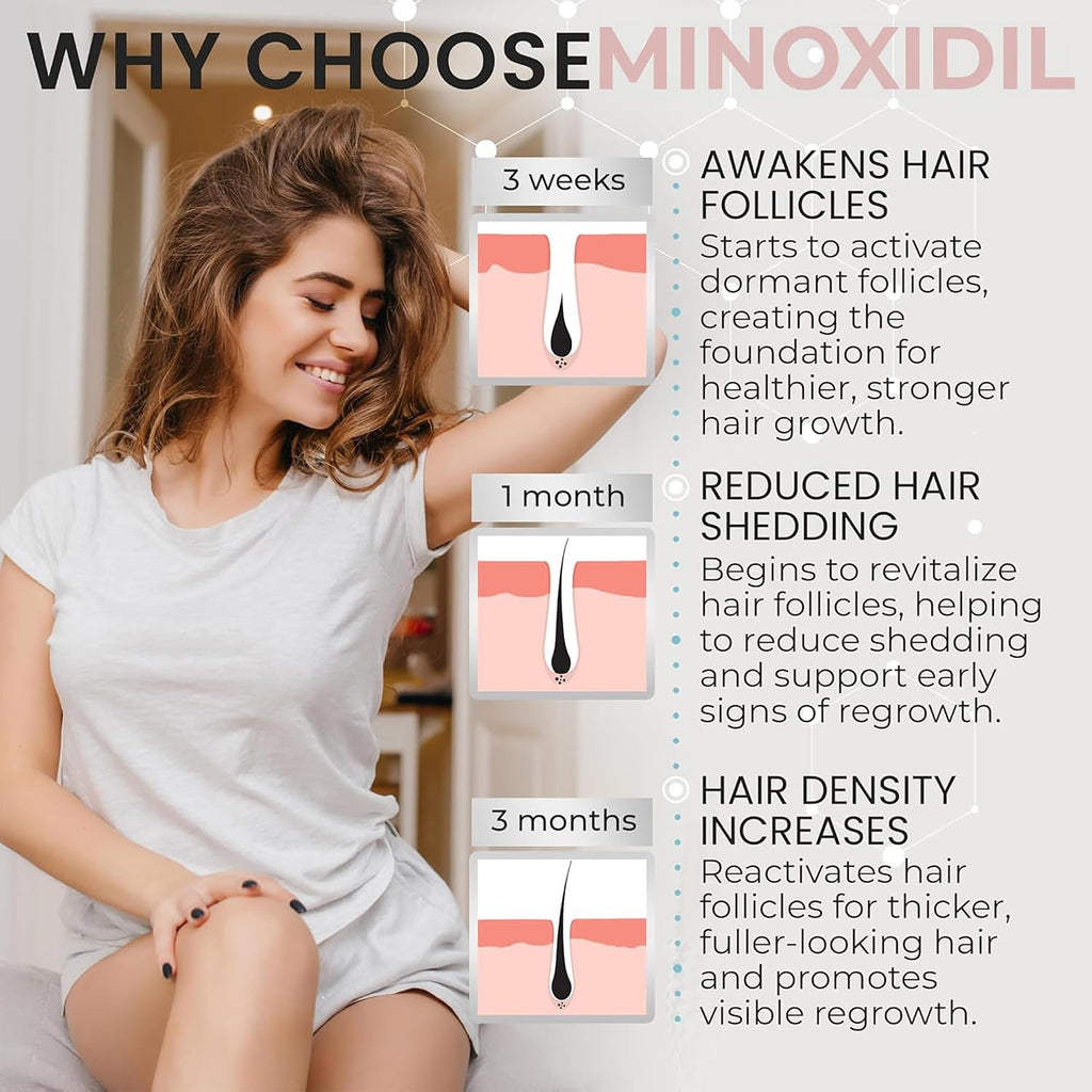 Minoxidil For Women | 5% Minoxidil For Women Hair Growth | Hair Regrowth Treatment | Unscented Topical Foam | Dermatologist Recommended | Clinically Proven Formula | 3 Month Supply