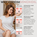 Minoxidil For Women | 5% Minoxidil For Women Hair Growth | Hair Regrowth Treatment | Unscented Topical Foam | Dermatologist Recommended | Clinically Proven Formula | 3 Month Supply