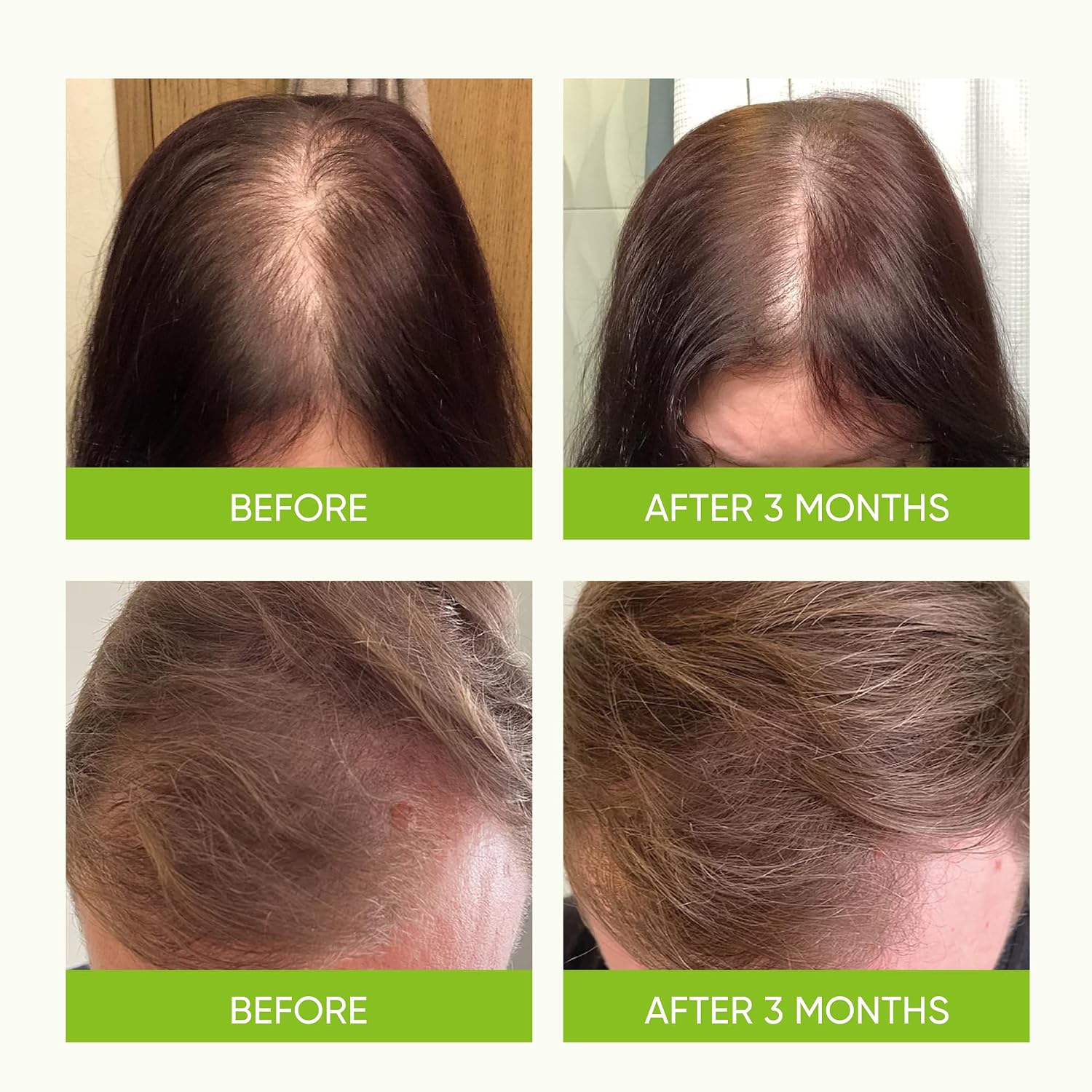 Hair Growth Serum Spray - With Rosemary Batana Oil Biotin For Hair Loss And Thinning Hair - Thicker Fuller Hair For Women Men 2 Fl Oz (Pack Of 1)