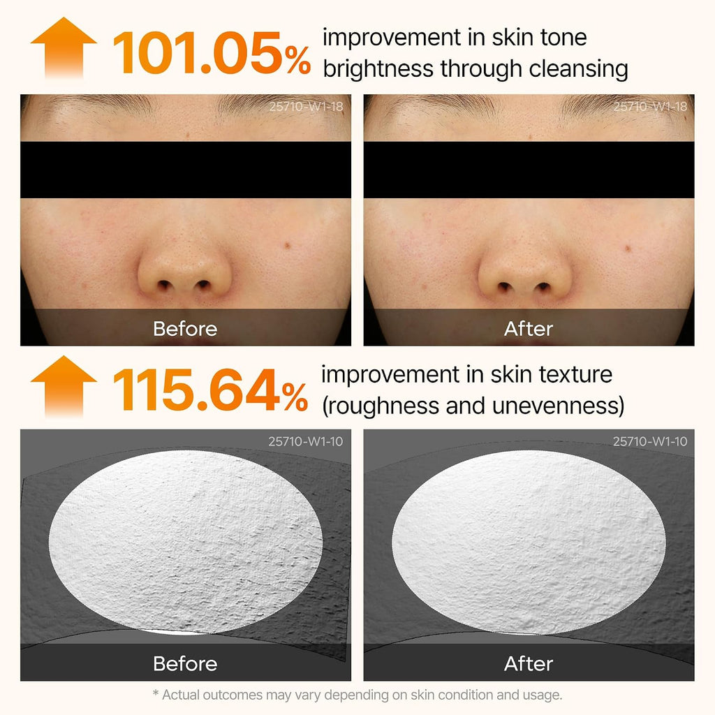 Dr. Melaxin Peel Shot Kojic Acid Turmeric Serum – Exfoliating Dark Spot Corrector With Aha/Bha & Niacinamide, Brightening & Even Tone Facial Serum (80Ml / 2.70 Fl Oz)