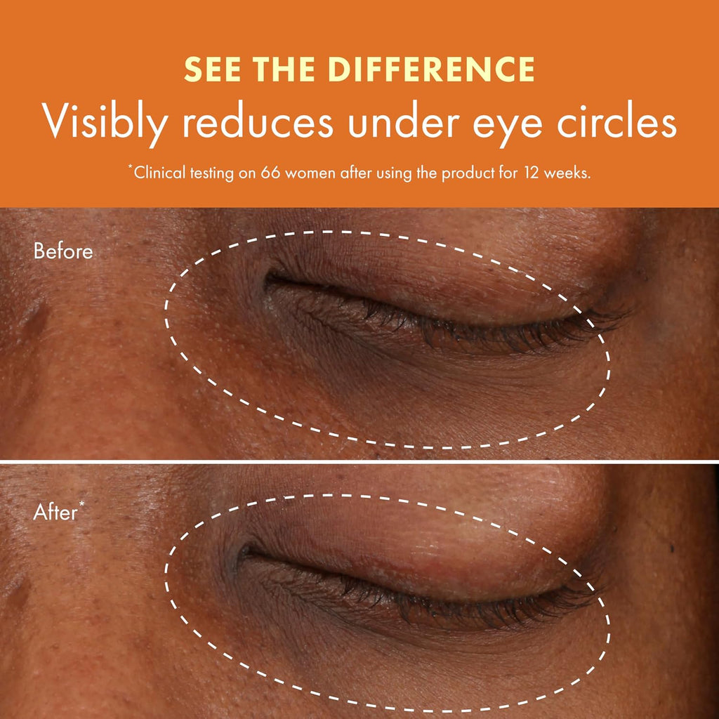 Origins Ginzing Brightening Eye Cream With Vitamin C & Niacinamide| Visibly Reduces Dark Circles, 0.5 Fl Oz