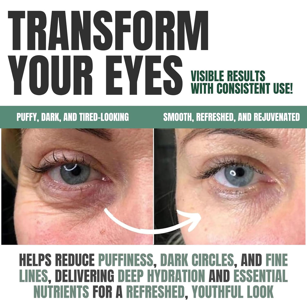 Wake Up Under Eye Gel Cream With Aloe Vera, Collagen & Cucumber, Anti-Aging, Hydrating, Soothing & Cooling Treatment For Dark Circles, Puffiness And Under Eye Bags, Fast-Absorbing, Day & Night