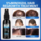 5% Minoxidil for Men Hair Loss Treatment, Minoxidil for Women Hair Growth Spray, For Men & Women, Supports Thinning Hair, With Biotin, Easy Daily Application (60ml)
