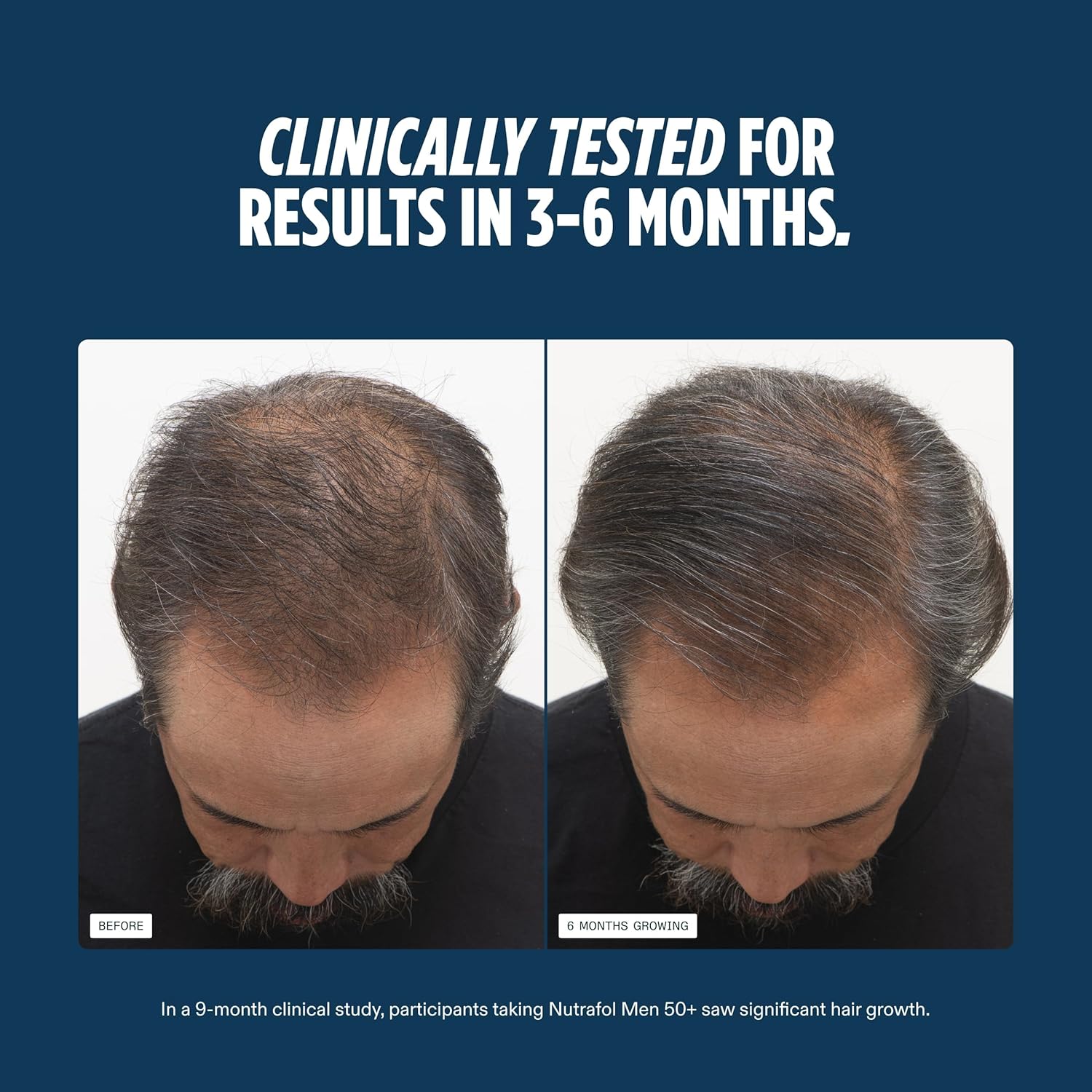 Nutrafol Men 50+ Hair Growth Supplements, Clinically Tested for Visibly Thicker Hair and Scalp Coverage, #1 Dermatologist-Recommended Hair Growth Supplement Brand - 1 Month Supply
