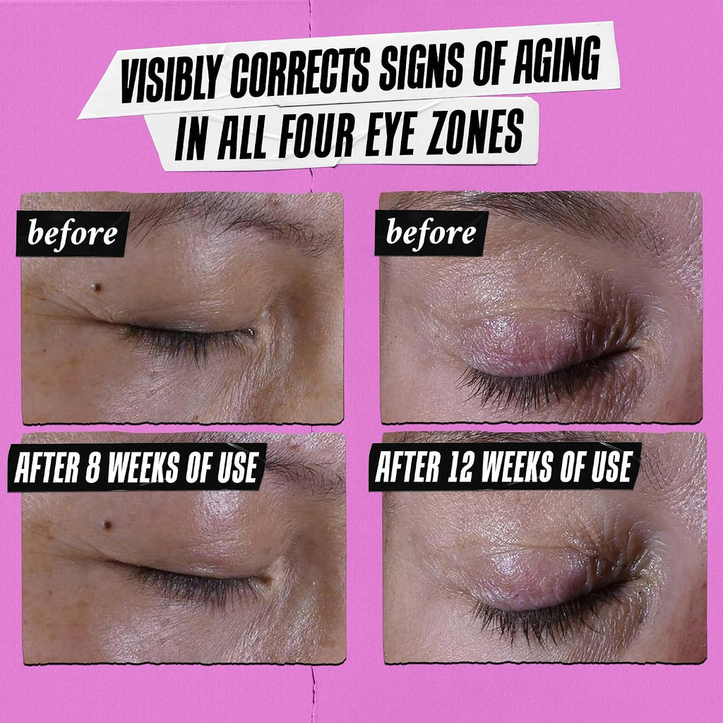 Kiehl'S Super Multi-Corrective Eye Cream, Anti-Aging Cream That Lifts Brow Bone Area, Smooths And Firms Eye Lids, Bilberry Seed Extract And Collagen Peptide For Tighter And Smoother Looking Skin