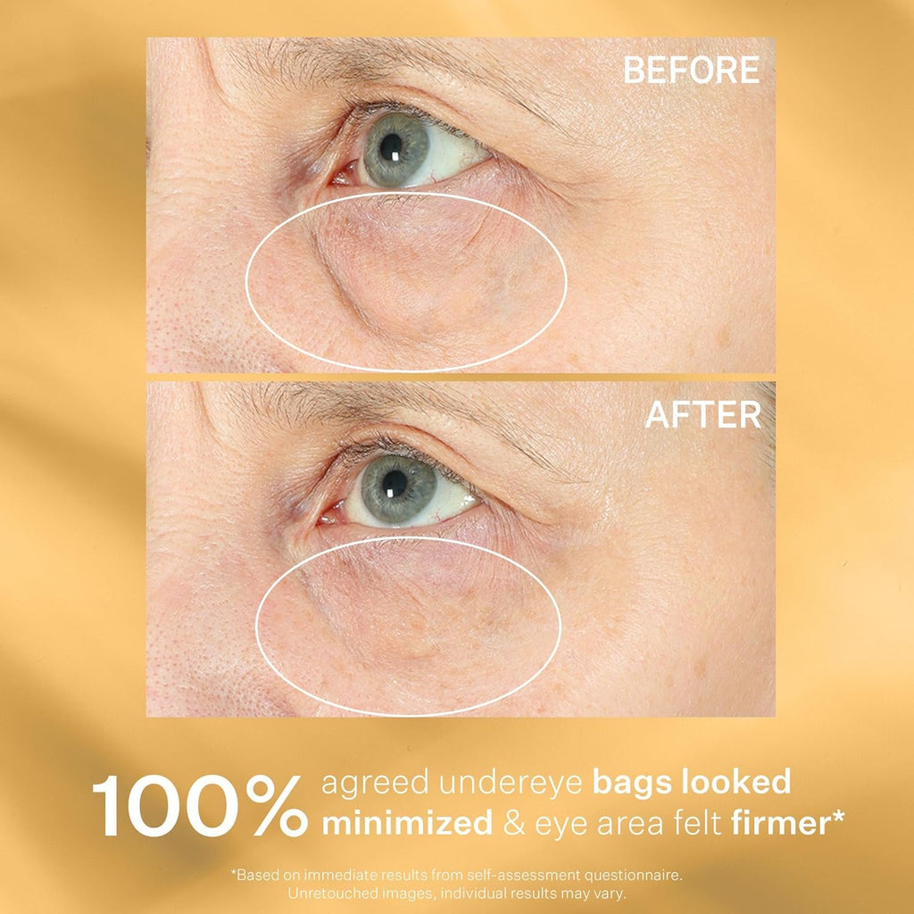 Strivectin Eye Cream Treatment, Firm, Tighten & Lift Eye Area For Bags