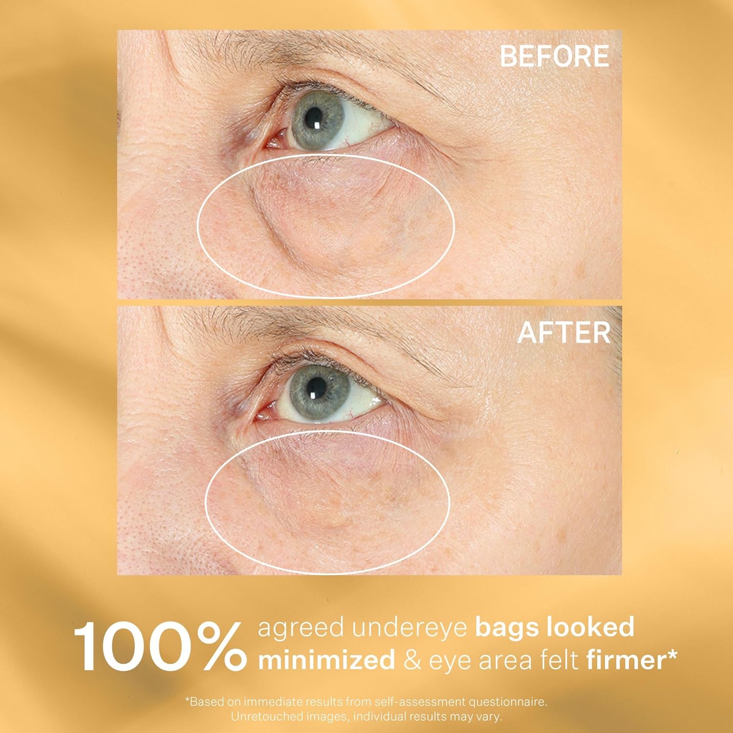 Strivectin Eye Cream Treatment, Firm, Tighten & Lift Eye Area For Bags