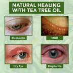 Noveha Tea Tree Oil Anti Wrinkle Eye Cream - Eyelid Cream For Dry & Itchy Skin, Scar | Moisturizer Face Cream Treatment - 1.69 Fl. Oz.