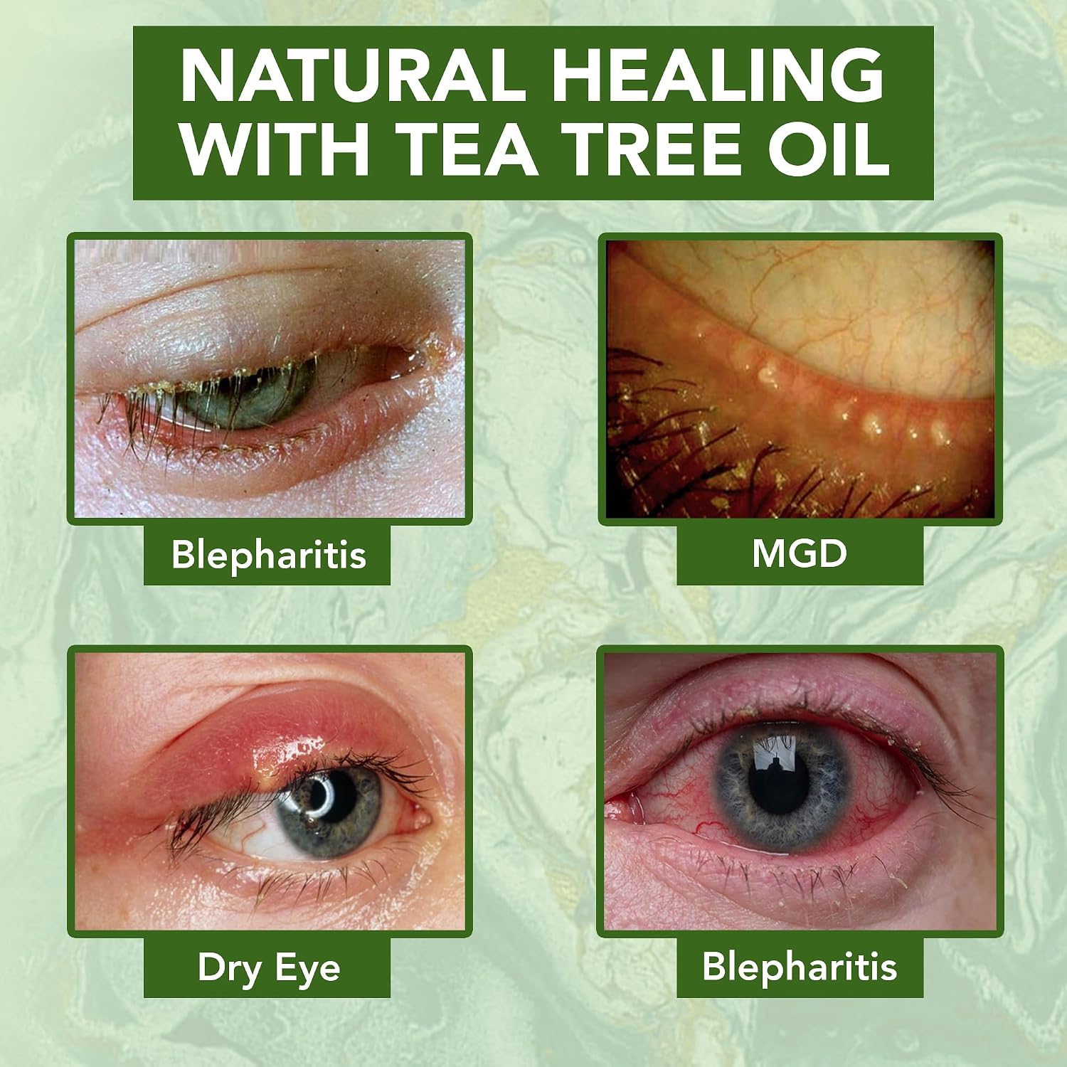 Noveha Tea Tree Oil Anti Wrinkle Eye Cream - Eyelid Cream For Dry & Itchy Skin, Scar | Moisturizer Face Cream Treatment - 1.69 Fl. Oz.