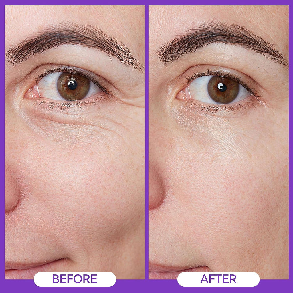 Eye Repair Cream 15Ml - Peptide Complex Eye Cream With 3 Essential Ceramides, Niacinamide & Hyaluronic Acid, Dermatologist Developed Anti-Aging Eye Treatment For Fine Lines, Dark Circles.