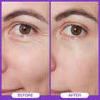 Eye Repair Cream 15Ml - Peptide Complex Eye Cream With 3 Essential Ceramides, Niacinamide & Hyaluronic Acid, Dermatologist Developed Anti-Aging Eye Treatment For Fine Lines, Dark Circles.