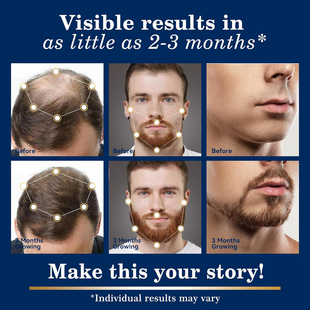 5% Minoxidil Hair Growth for Men and Women: Regrowth Topical Solution for Beard Spray Kit - Extra Strength Treatment with Minoxidil and Biotin for Hair loss & Thinning to Grow Thicker Serum - 2PCS