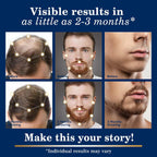 5% Minoxidil Hair Growth for Men and Women: Regrowth Topical Solution for Beard Spray Kit - Extra Strength Treatment with Minoxidil and Biotin for Hair loss & Thinning to Grow Thicker Serum - 2PCS