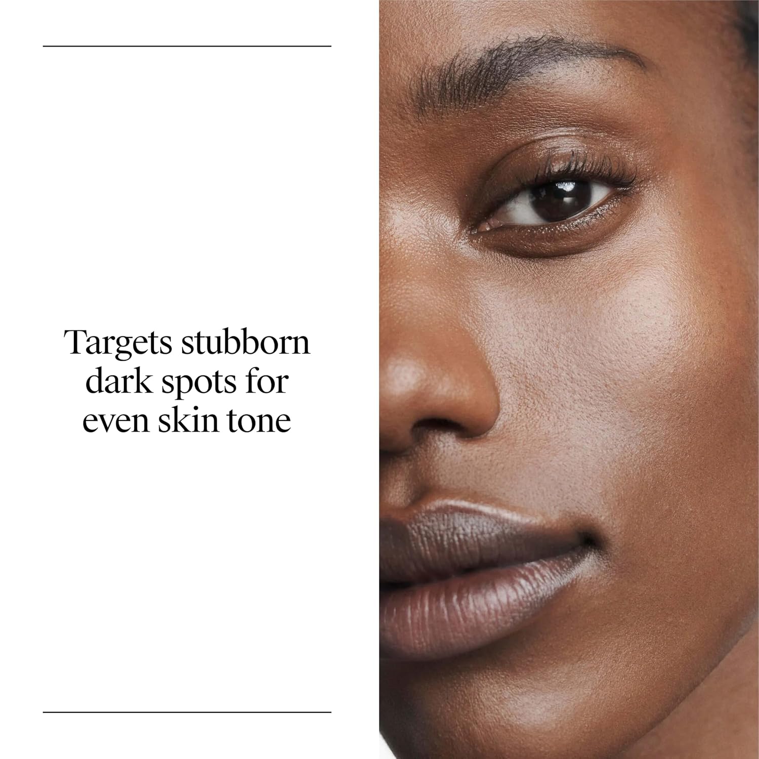 Neutrogena Rapid Tone Repair Retinol + Vitamin C Dark Spot Corrector For Face Daily Anti-Aging Serum Brightens And Evens Tone, Mineral Oil And Dye Free, 1 Fl Oz