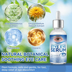 Stye Eye Treatment, 30Ml Natural Eye Serum, Eye Stye Relief Serum For Eye Styes, Blepharitis, Chalazions And Dry Eyes Treatment, Daily Area Cleansing, Relieves Dryness And Restores Healthier Skin