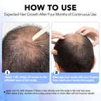 Minoxidil for Men-5% Extra Strength Hair Regrowth for Men Treatment-5% Topical Solution-Dropper Applicator Included -Minoxidil for Women-Stop Thinning & Hair Loss (1)