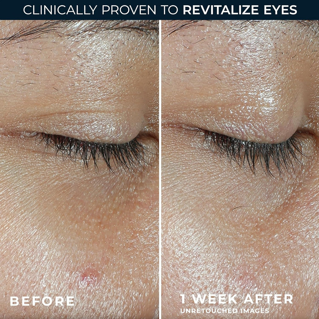 Roc Multi Correxion Revive + Glow Eye Balm With Vitamin C (0.14 Oz) + Retinol Eye Cream Packette