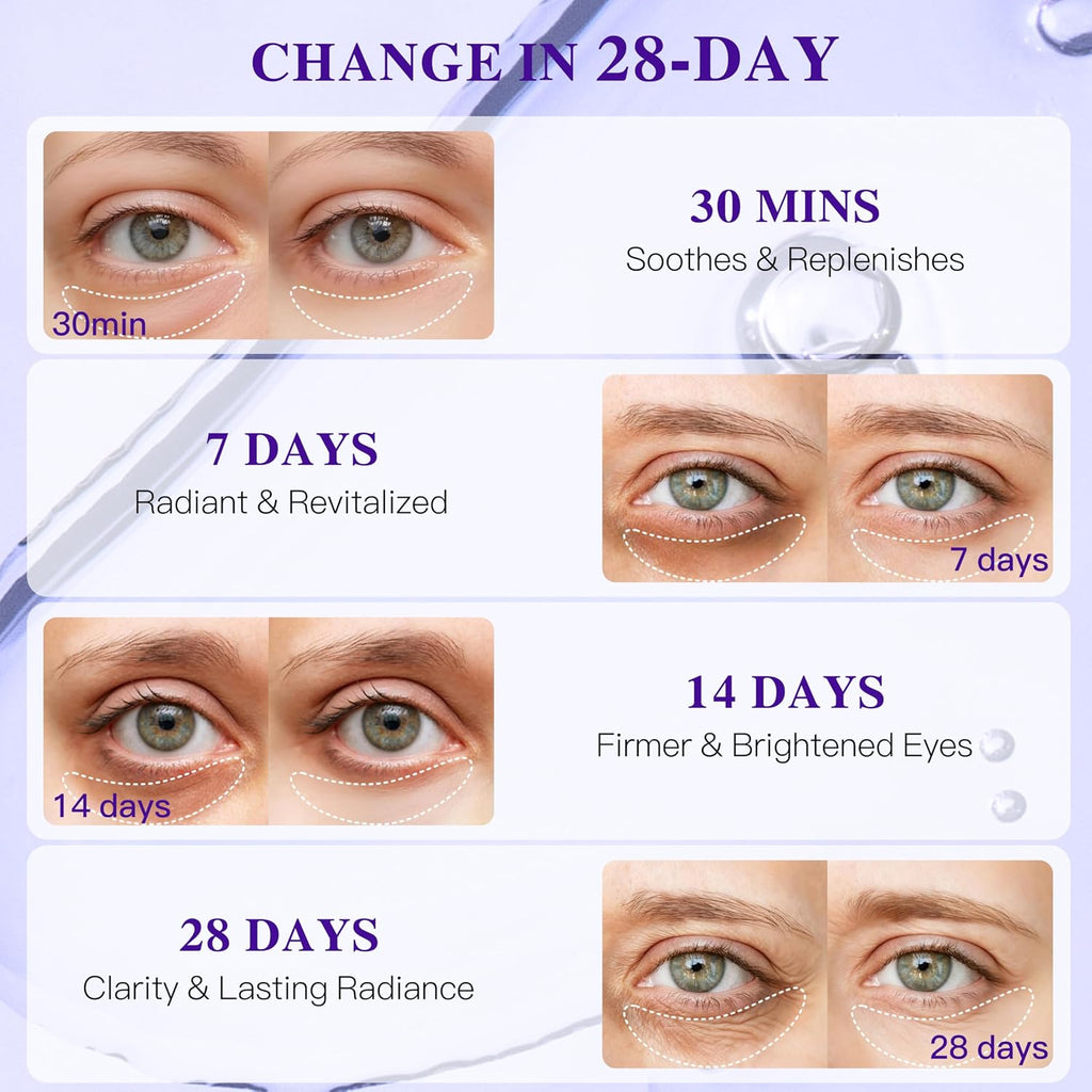 Grape Seed Collagen Under Eye Patches, Eye Mask For Puffy Eyes And Dark Circles, Deep Hydrating Under Eye Mask Patches For Eye Bags Treatment, Under-Eye Skincare Boost Radiance (12 Pairs)