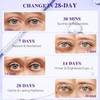 Grape Seed Collagen Under Eye Patches, Eye Mask For Puffy Eyes And Dark Circles, Deep Hydrating Under Eye Mask Patches For Eye Bags Treatment, Under-Eye Skincare Boost Radiance (12 Pairs)
