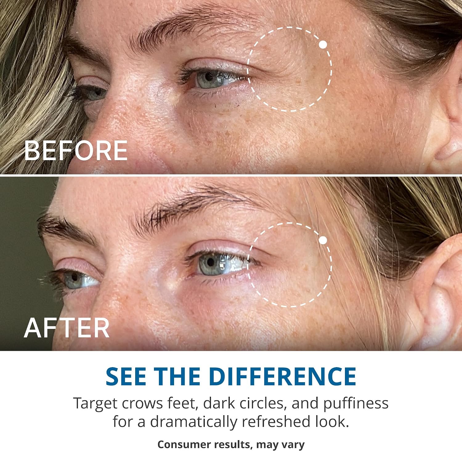 Gopure Advanced Repair Eye Cream - Under Eye Cream For Puffiness, Bags, And Dark Circles, Visibly Improve The Look Of Fine Lines, Wrinkles, And Crows Feet - 0.57 Fl Oz
