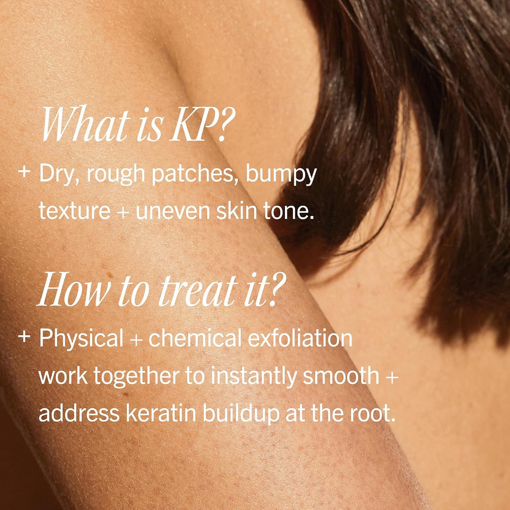 First Aid Beauty - Kp Bump Eraser Body Scrub, Keratosis Pilaris Exfoliator With Glycolic And Lactic Acids, Helps Reduce Chicken Skin Bumps, Safe For Sensitive Skin