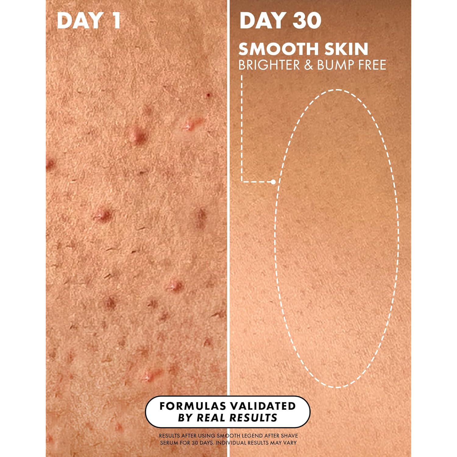 Truly Luxury After Shave Serum | Soothing & Hydrating Post Shave Treatment to Prevent Ingrown Hair For Smooth, Irritation-Free Skin