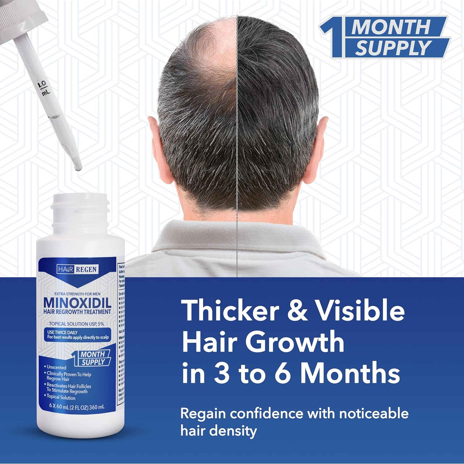 Hair Regen Liquid Minoxidil for Men 5% – Advanced Topical Solution for Regrowth – Growth Treatment for Men Hair Loss 6-Pack as 6-Month Supply Kit