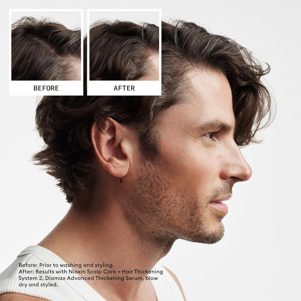 Nioxin System 2 Scalp Care + Hair Thickening Leave-In Treatment | For Natural Hair with Progressed Thinning | Boost Hair Density & Strengthen Against Breakage with Niacinamide & Biotin