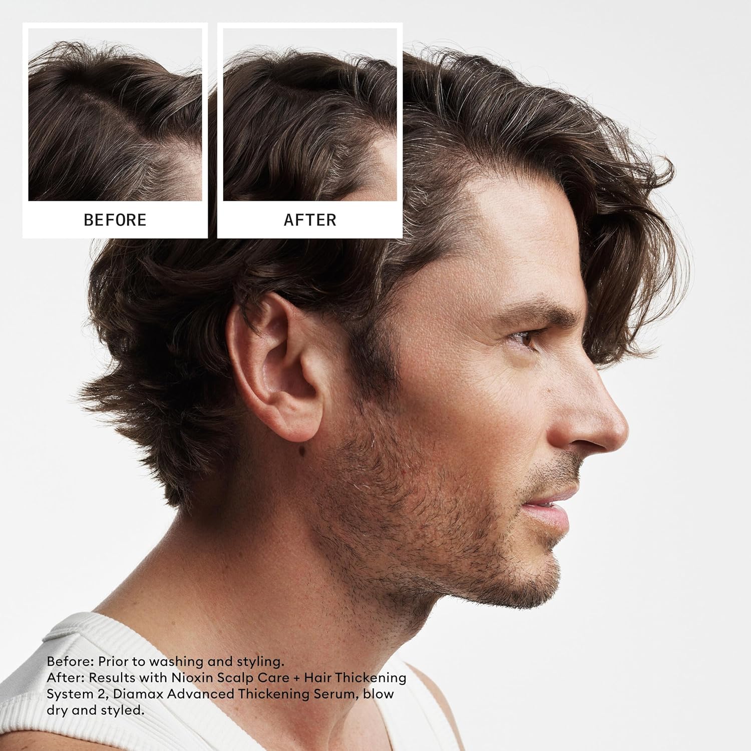 Nioxin System 2 Scalp Care + Hair Thickening Leave-In Treatment | For Natural Hair with Progressed Thinning | Boost Hair Density & Strengthen Against Breakage with Niacinamide & Biotin