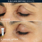 Roc Retinol Correxion Value Set Duo, Deep Wrinkle Anti-Aging Night Face Cream + Under Eye Cream For Dark Circles & Puffiness - Retinol Eye Care