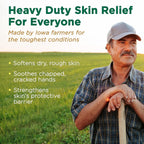 Corn Huskers Hand Lotion for Dry, Cracked Hands, Fast Absorbing, Non-Greasy Protective Barrier Cream For Men and Women, 7 Fluid Ounce